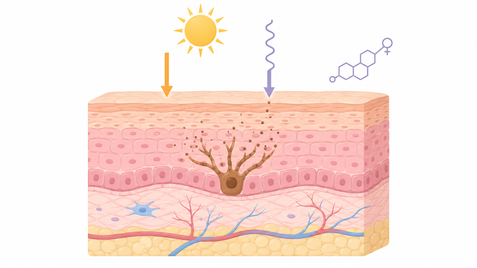 Songdo Human Dermatology_causes of skin pigmentation