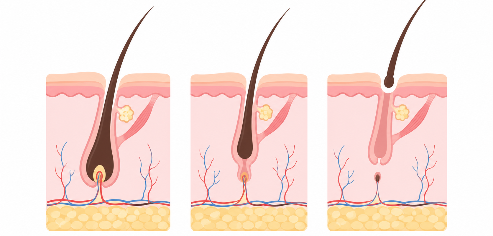 Songdo Human Dermatology_hair growth cycle and follicle stages
